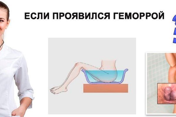 Кракен как попасть